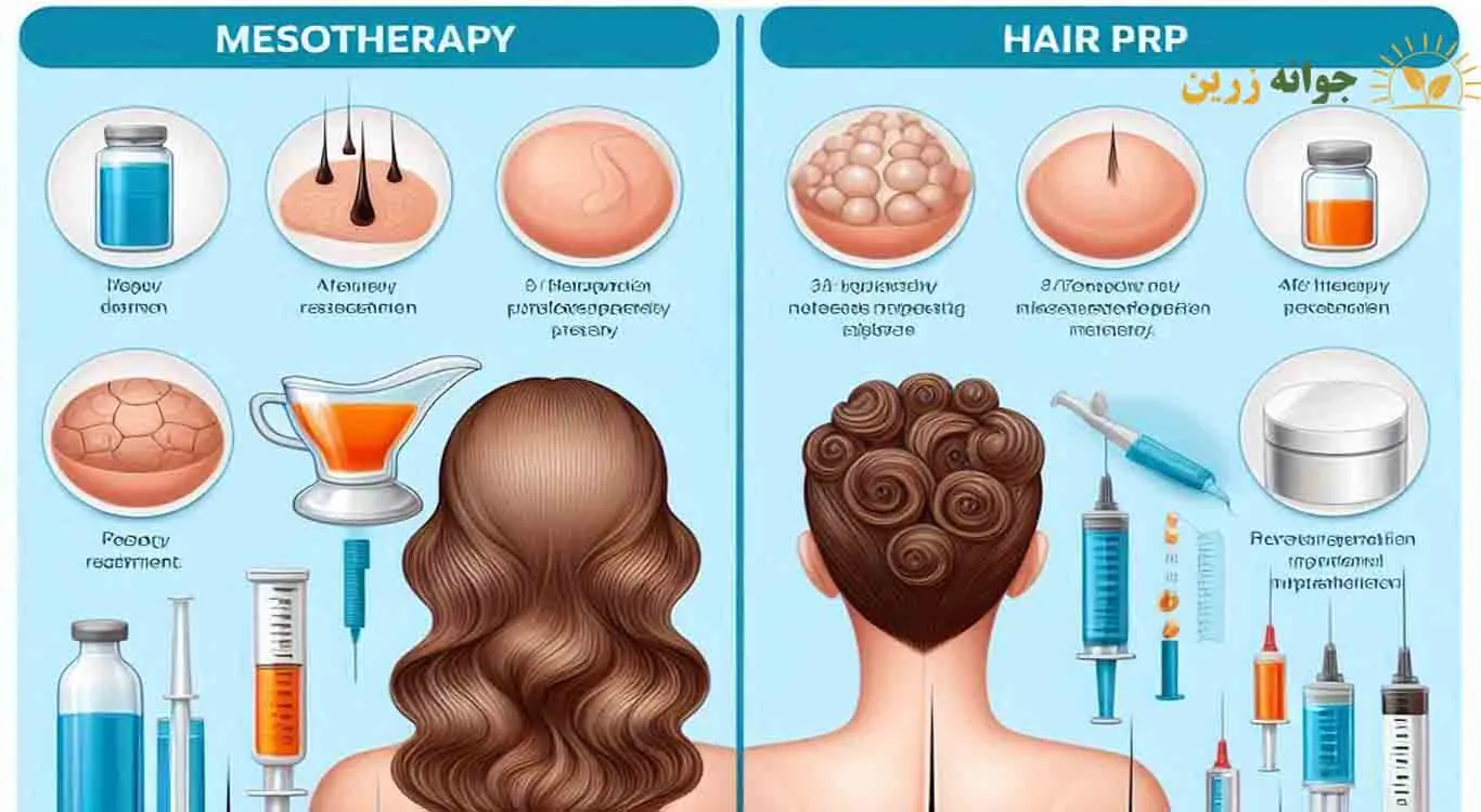 After-hair-transplant-PRP-or-mesotherapy After-hair-transplant-PRP-or-mesotherapy