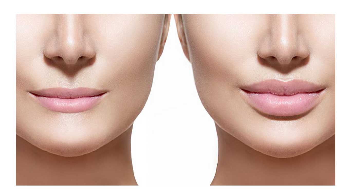 Central-lip-with-thread