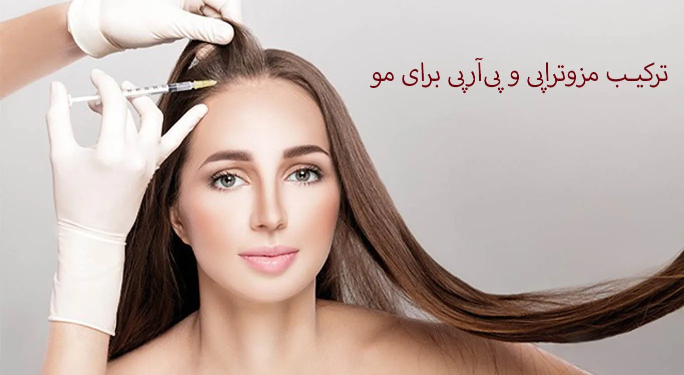 Combining-Mesotherapy-and-PRP-for-Hair-Growth