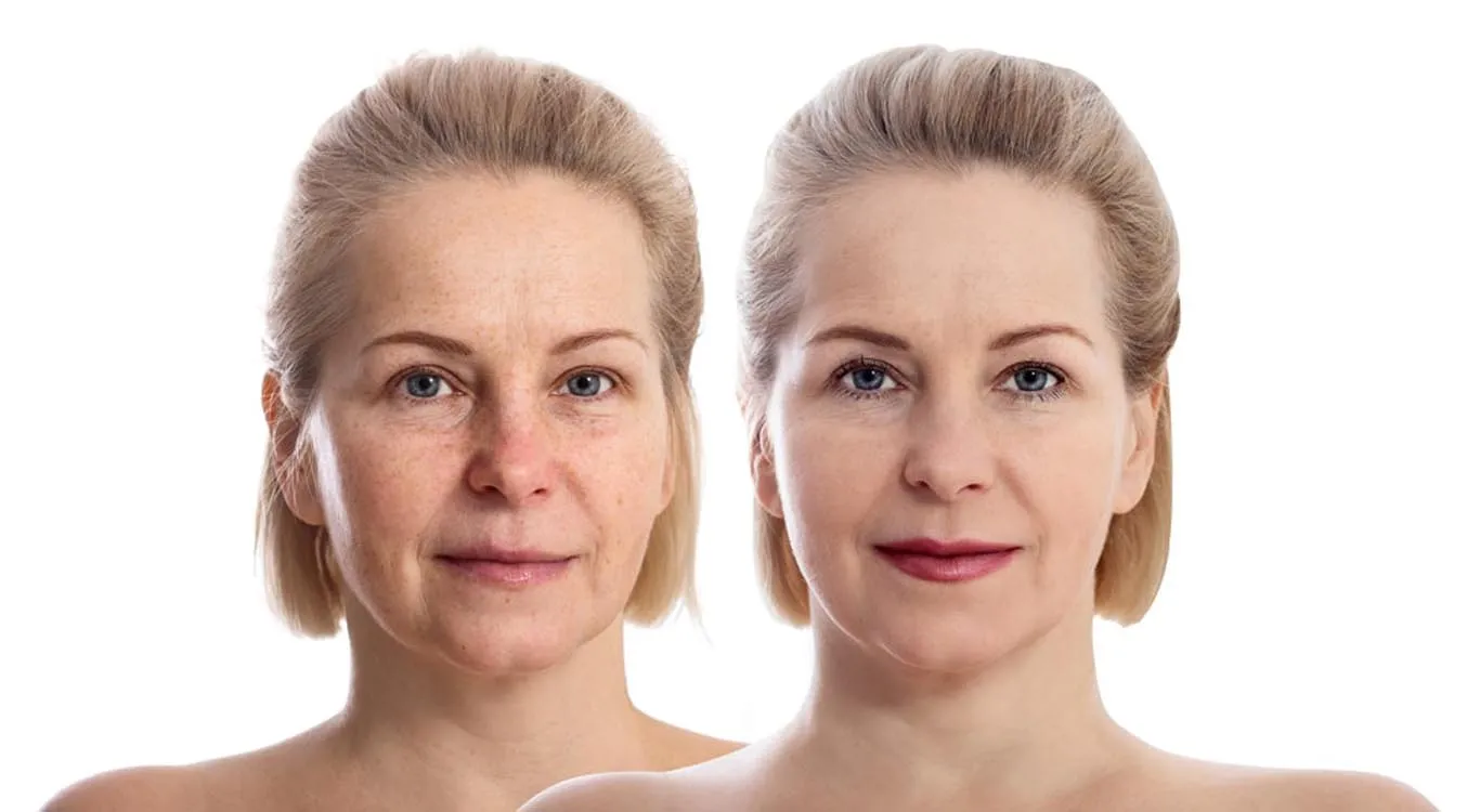 Comparison-of-Botox-fillers-and-injectables