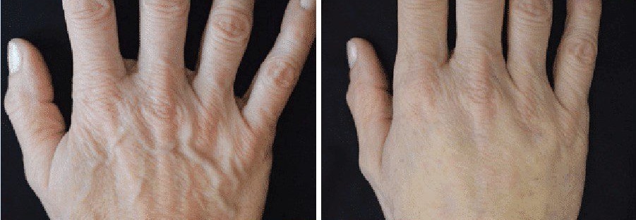 Comprehensive-Offline-Body-Filler-Training