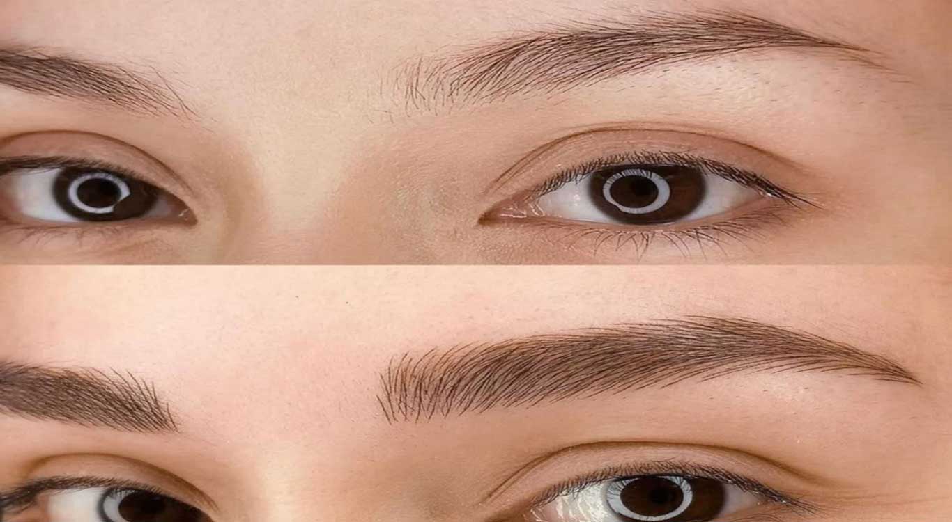 Eyebrow-Transplantation-vs.-Microblading