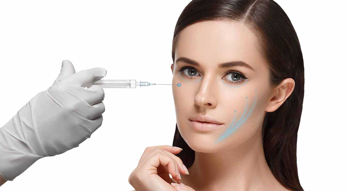 Facelift-with-fillers