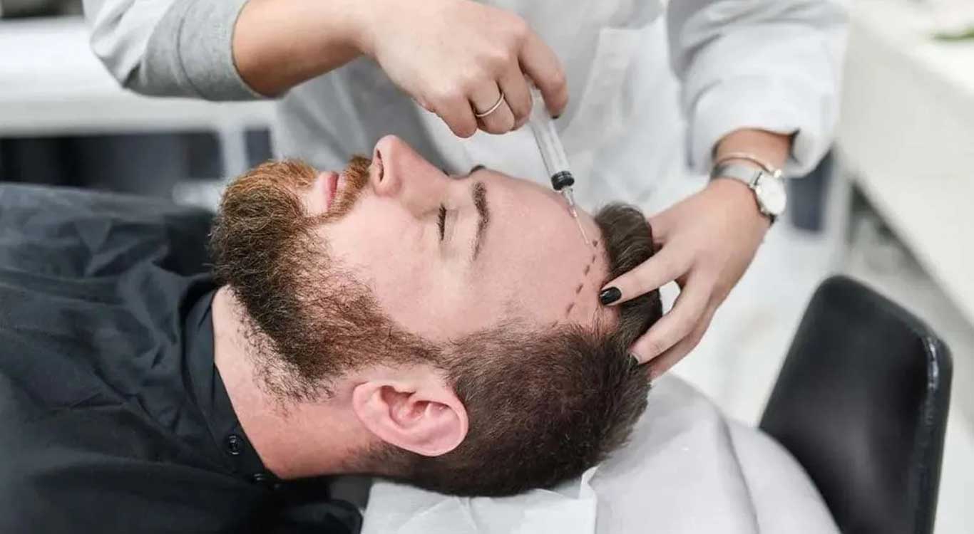 Necessary-tests-before-hair-transplantation