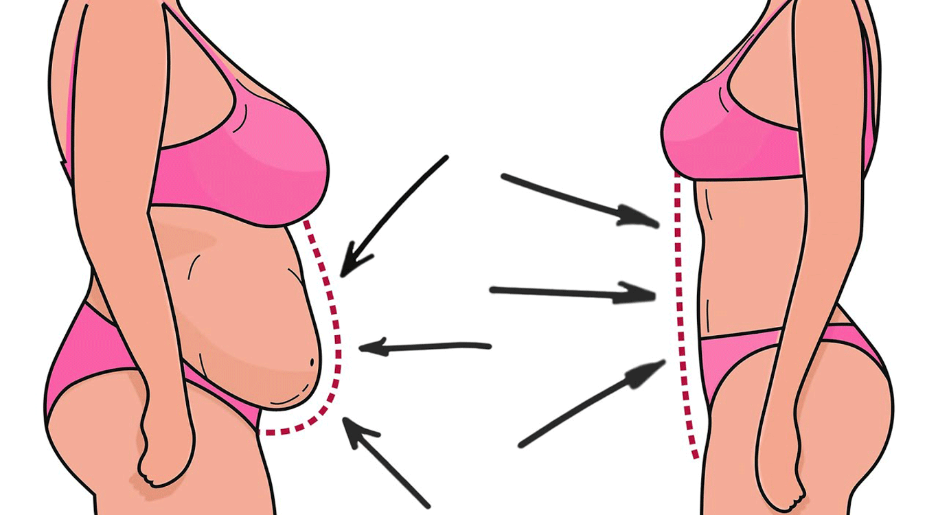 Postpartum-cosmetic-surgery