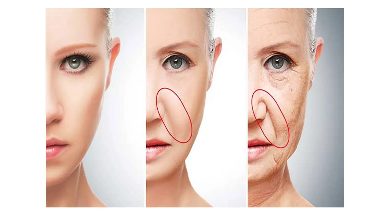 The-best-facial-fillers-comparing-brands