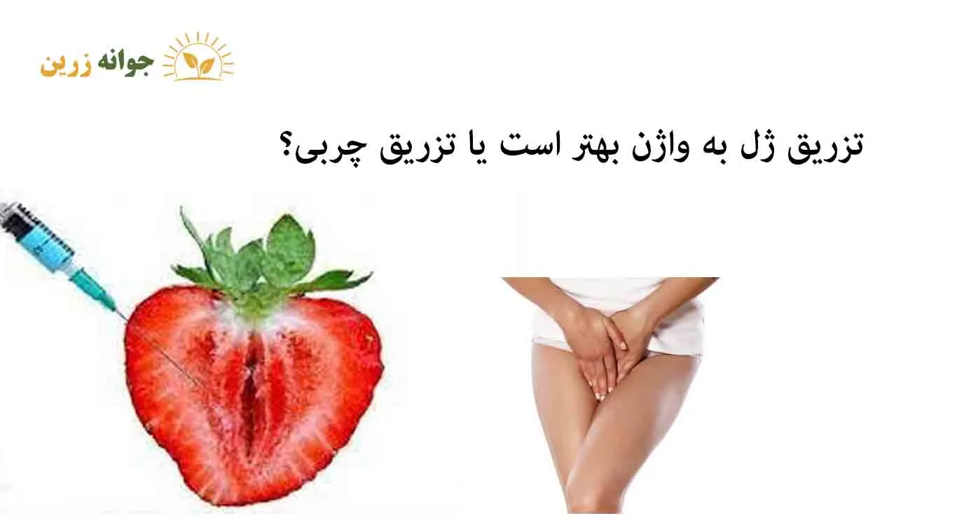 Vaginal-gel-injection-or-fat-injection Vaginal-gel-injection-or-fat-injection