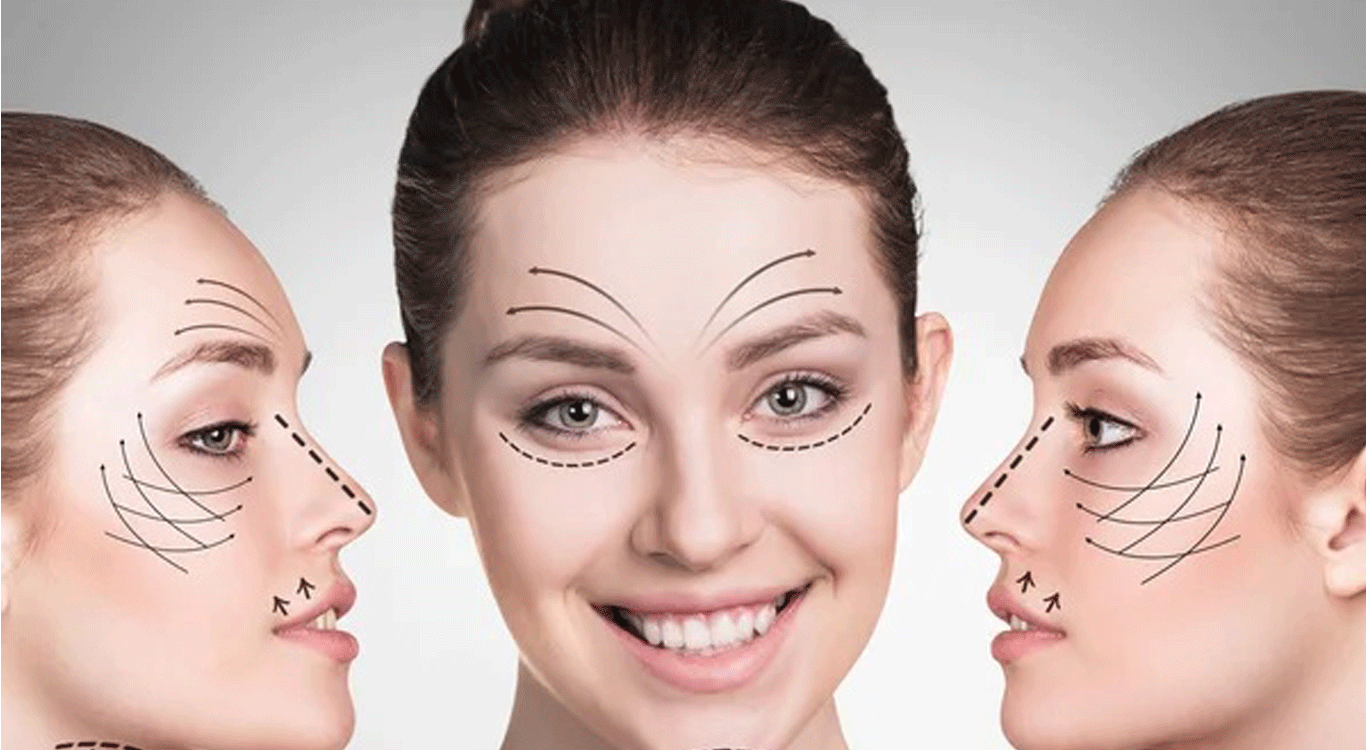 What-is-a-direct-eyebrow-lift