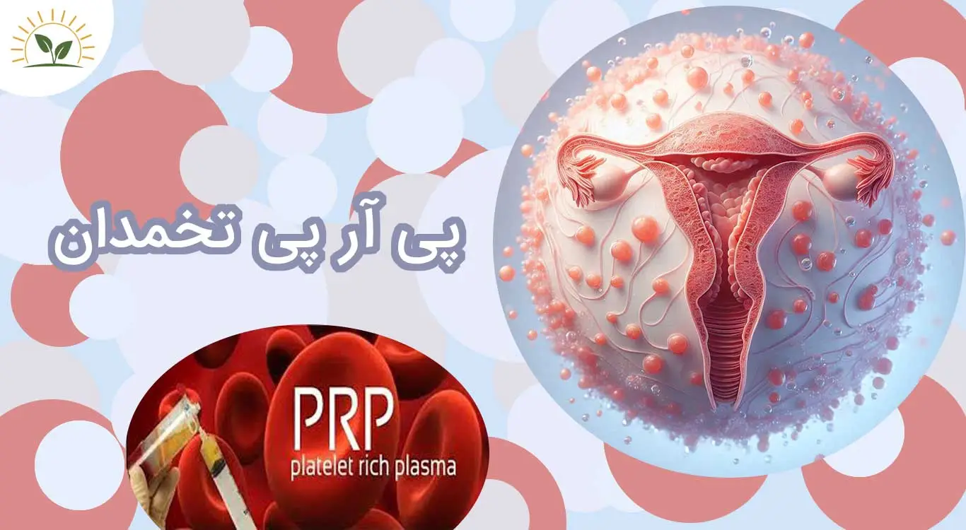 What-is-ovarian-PRP